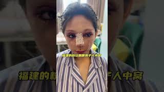 福建组团过来的姐妹#整形 #医美 #facelift #大拉皮 #拉皮 #nose #eyes ￼