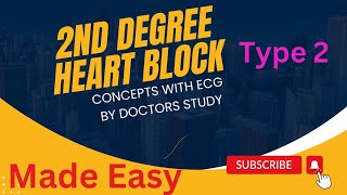 2nd Degree Heart Block Type 2 - Mobitz 2 - Second Degree Heart Block - Doctorsstudy