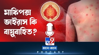 TV9 BANGLA PODCAST: গুটিবসন্তের থেকে কতটা আলাদা মাঙ্কিপক্স?