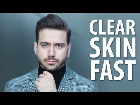 HOW TO GET CLEAR SKIN FAST | Men's Skincare Routine | ALEX COSTA HOW TO GET CLEAR SKIN FAST | Men's Skincare Routine | ALEX COSTA