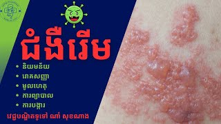 ជំងឺរើម វេជ្ជ. ណាំ​ សុខណាង Dr.Nam Soknang