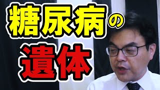 糖尿病の人の遺体は腐敗しやすいの？何か気を付けることはあるの？葬儀・葬式ｃｈ 第1224回