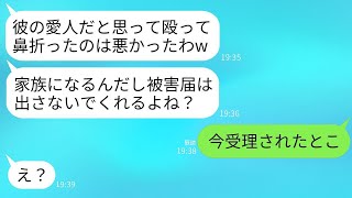 兄の結婚式の前日、妹の私が遊んでいたところ、兄の婚約者に鼻を折られた。「泥棒猫と勘違いした」という理由で。