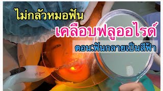 เคลือบฟลูออไรด์ fluoride ไม่เจ็บ เด็กๆไม่ต้องกลัวนะ