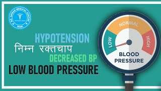 Hypotension | Low Blood Pressure | How to Control Low BP | निम्न रक्तचाप | Decreased BP