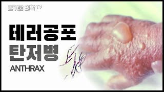 탄저병에 걸리면 어떤 증상이 나타날까?  [feat. 트랩]