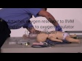 aemt i99 paramedic advanced skills pediatric ventilatory management emtprep.com