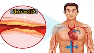 چەند خواردنێکى بەسوود بۆ کەمکردنەوەى چەورى خوێن