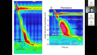 SAGES Foregut Facebook Group Esophageal Motility Livestream