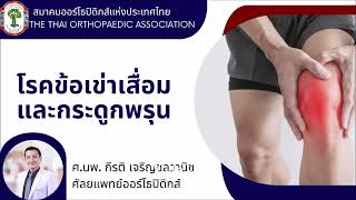 กระดูกพรุน ปวดเข่าข้อเข่าเสื่อม สะโพกเสื่อม ศ.นพ.กีรติ เจริญชลวานิช #สมาคมออร์โธปิดิกส์แห่งประเทศไทย