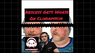 Abscess gets Worse on Clindamycin