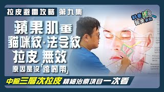 【拉皮避雷攻略｜第九集】中臉拉皮手術效果差？原來是敗在沒有「跨韌帶」！  蘋果肌下垂、貓咪紋、法令紋一次改善到位就靠—耳廓短痕三層次緊顏拉皮 中臉精細治療項目大公開科普醫美新知163-20200717