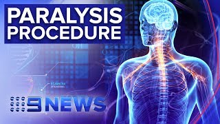 The nerve transfer surgery restoring movement to quadriplegics | Nine News Australia