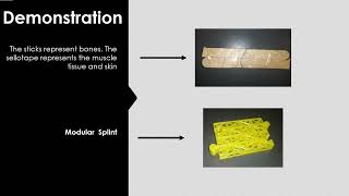 Modular Splint - Group L G2 (Project 3)