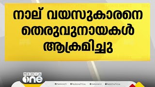 ഗുരുവായൂരിൽ നാല് വയസ്സുകാരനെ തെരുവുനായകൾ ആക്രമിച്ചു | Dog attack | Guruvayoor