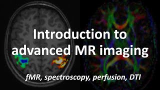Advanced MR imaging: Introduction to fMRI, DTI, spectroscopy & MRI perfusion