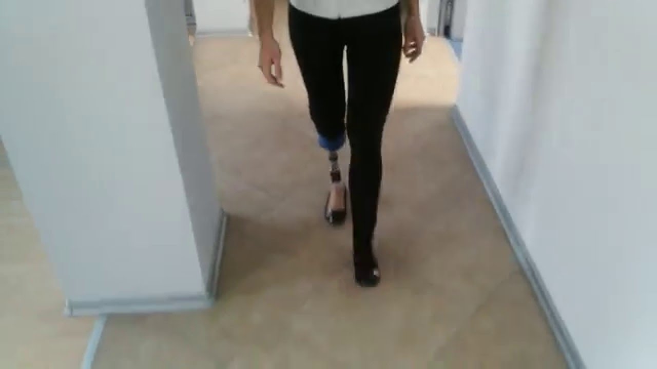 My First Steps / New Leg / Amputee - YouTube