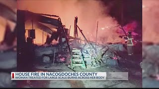 Nacogdoches County woman taken to Houston-area hospital after being burned in Monday night house fir