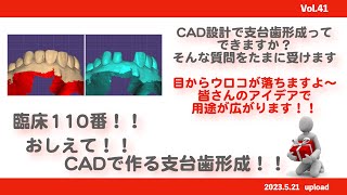 【exocad】臨床110番！おしえて！！CADで作る支台歯形成