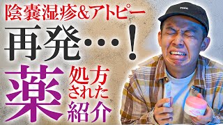 金玉がかゆい陰嚢湿疹とアトピーが再発！皮膚科で処方された塗り薬とか紹介します【ステロイド】【飲み薬】