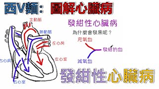 [西V麵圖解心臟病]：發紺性心臟病？為什麼會發紺呢？