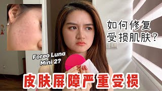 我之前是怎么把我的皮肤屏障给搞坏的 \u0026 如何修复受损肌肤 | How I destroy and repair my skin barrier | 痘痘 发痒 发红 皮肤起屑