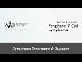 PERIPHERAL T CELL LYMPHOMA