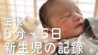 【新生児】生後5分から5日目までの記録