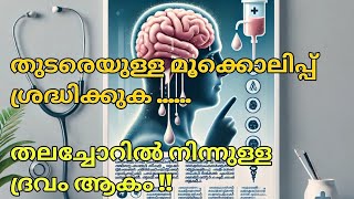 മൂക്കൊലിപ്പ് തുടർച്ചയായി ഉണ്ടാകുന്നെങ്കിൽ ശ്രദ്ധിക്കുക / CSF RHINORRHOEA