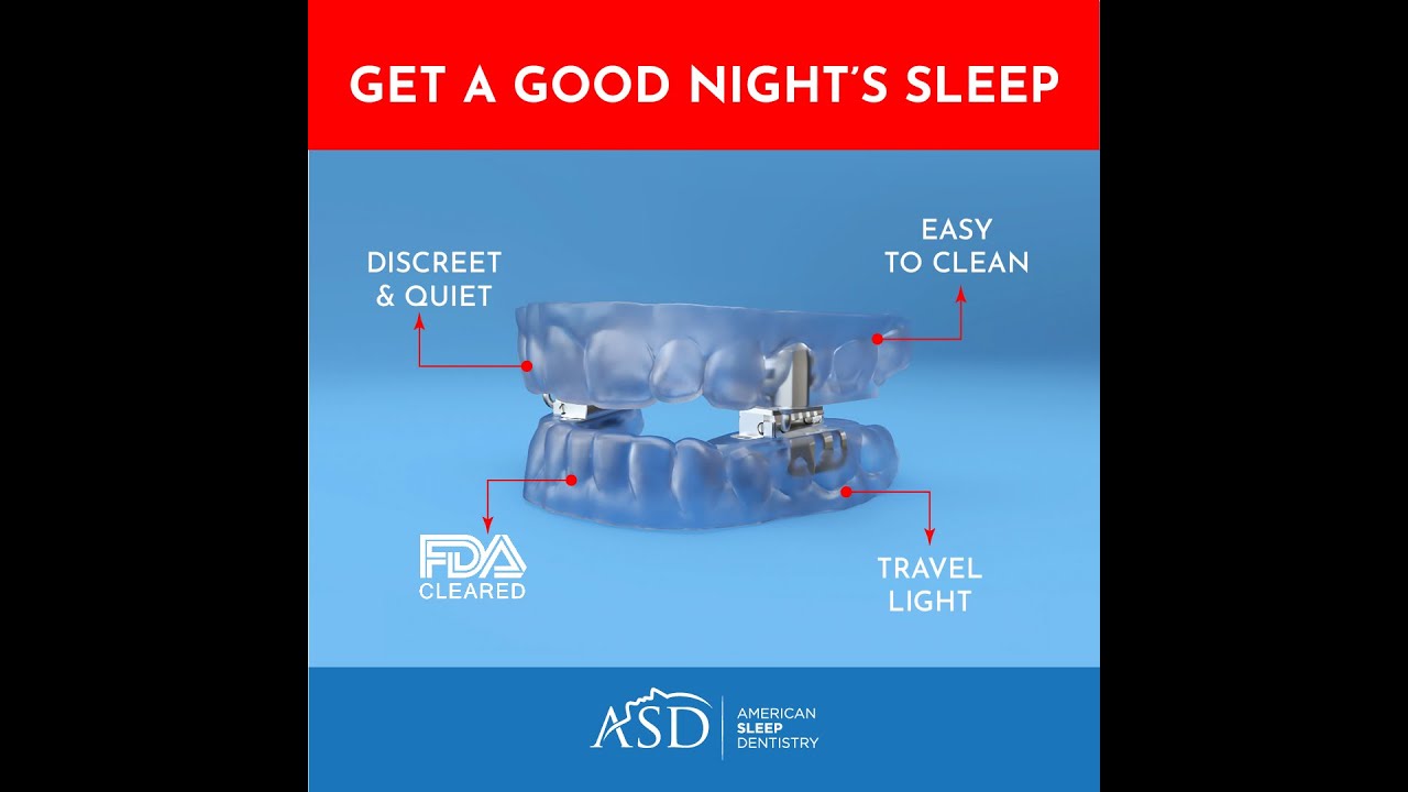 American Sleep Dentistry Sleep Appliance Better Than A CPAP. - YouTube