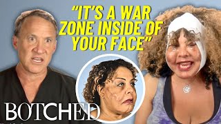 Botched OG Rajee Returns for a Third Time to Remove MORE Facial Lumps | Botched | E!