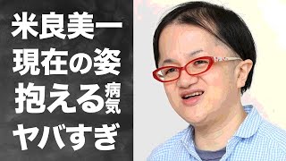 【衝撃】米良美一の現在の姿や病気と戦う人生に涙が零れ落ちた...「もののけ姫」の主題歌で有名な歌手のパートナーの正体に驚きを隠せない！