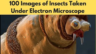 100 Images of Insects Taken Under Electron Microscope