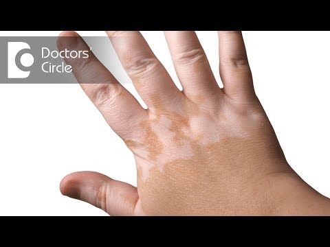 Ways to increase melanin secretion in body - Dr. Sachith Abraham Ways to increase melanin secretion in body - Dr. Sachith Abraham