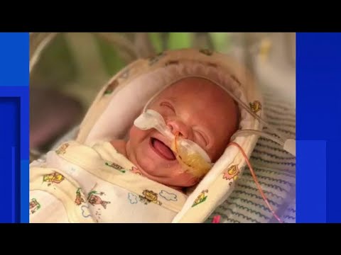 Can a baby born at 24 weeks survive?