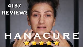 Hanacure Facial In A Box Is It Worth It? 4,137 5 Star Reviews!