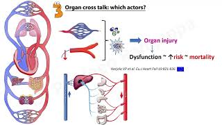 Acute Pulmonary Edema ~ 10 questions Intensivist should know