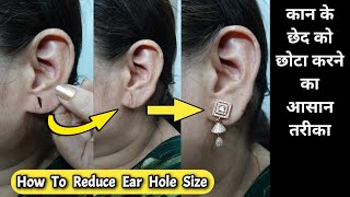 कान के छेद को छोटा करने का आसान तरीका | How To Reduce Ear Hole Size