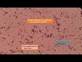 Gram positive and Gram negative bacterial slides under the Microscope