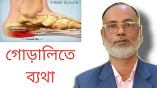 গোড়ালীতে ব্যথা বা হাড় বেড়ে যাওয়া কি? What Is Heel Spur? M Anwar Hossain