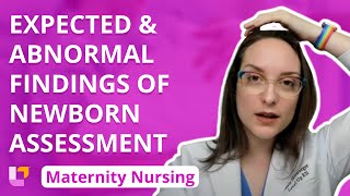 Expected and Abnormal Findings of Newborn Assessment - Maternity Nursing- Newborn Care | @LevelUpRN