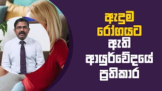 ඇදුම රෝගයට ඇති ආයුර්වේදයේ ප්‍රතිකාර | Piyum Vila | 05 - 07 - 2021 | SiyathaTV