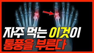 평소 자주 먹는 이것이 통풍을 부른다