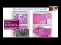 MTOS 2021 Molecular Workshop: Molecular Landscape of Thyroid Nodules and Cancer