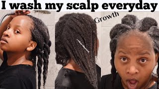 Washing my scalp everyday Is GROWING My hair very fast! Wash Day routine for natural type 4c hair