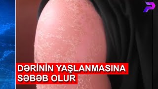 YAYDA MÜTLƏQ BUNLARA ƏMƏL EDİN