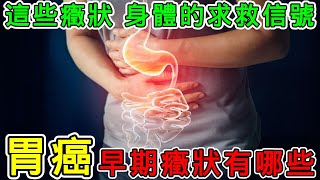 【健康】胃癌的早期症状有哪些？#健康 #養生