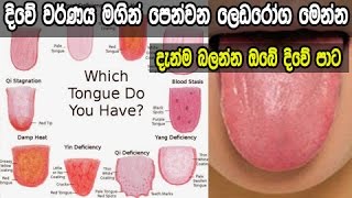 දිවේ වර්ණය මගින් පෙන්වන ලෙඩරෝග මෙන්න  - What is Your Tongue Colour Reveals About Your Health