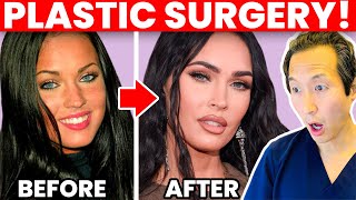 MEGAN FOX Cosmetic Surgery Transformation!