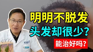 【毛发问题】明明不脱发，头发却显得很少！这样能治好吗？雍禾植发|马晓阳医师